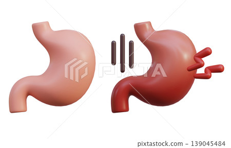 Healthy Stomach and Sick Stomach 3D Illustration Healthy Stomach and Sick Stomach 3D Illustration 139045484