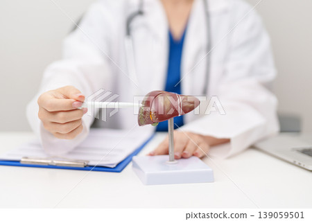 Doctor with human Liver anatomy model. Liver cancer and Tumor, Jaundice, Viral Hepatitis A, B, C, D, E, Cirrhosis, Failure, Enlarged, Hepatic Encephalopathy, Ascites Fluid in Belly and health concept 139059501