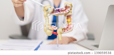 Doctor with human Colon anatomy model. Colonic disease, Large Intestine, Colorectal cancer, Ulcerative colitis, Diverticulitis, Irritable bowel syndrome, Digestive system and Healthcare concept 139059538