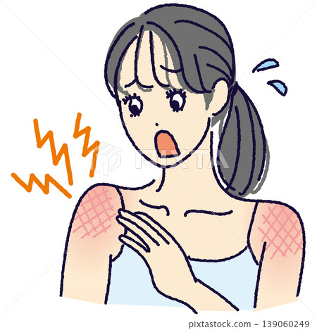 An illustration of a woman who is surprised to notice she has a sunburn (redness, stinging, UV damage). 139060249
