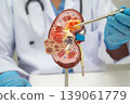 Kidney disease, Chronic kidney disease ckd, Doctor hold human model. 139061779