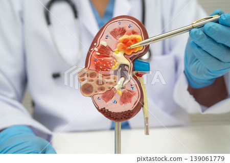 Kidney disease, Chronic kidney disease ckd, Doctor hold human model. 139061779