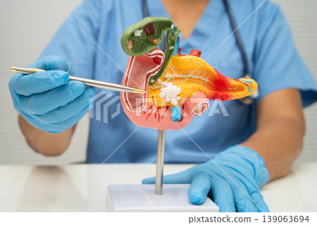 Pancreatitis, pancreatic cancer, Asian doctor with pancreas, gallbladder and bile duct human anatomy model at hospital. 139063694