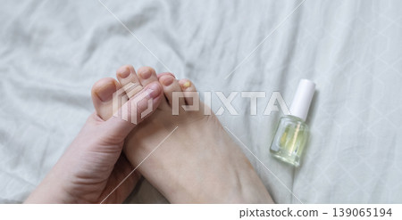 A woman in pajamas sitting on a bed and applying antifungal nail polish to treat onychomycosis. Home treatment of fungal infection, yellow nails, and medical pedicure for healthy feet. 139065194