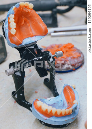 Detailed denture model showcasing craftsmanship in dental design workshop 139094195