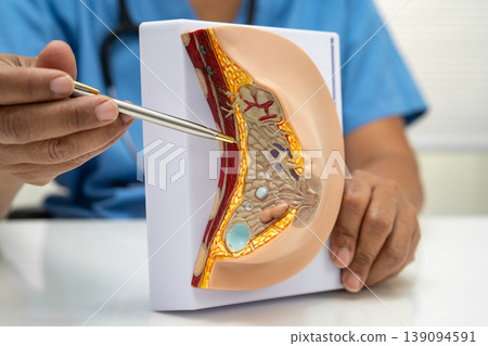 doctor holding female breast human anatomy model. 139094591