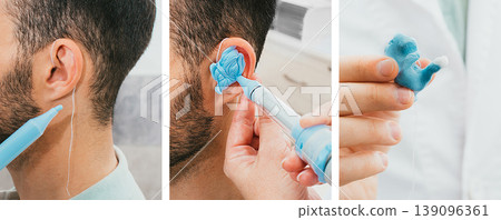 Set of making a custom earplug for a man. Stages of manufacturing earplugs. Doctor makes custom molded ear plugs for the patient. Ear close-up 139096361