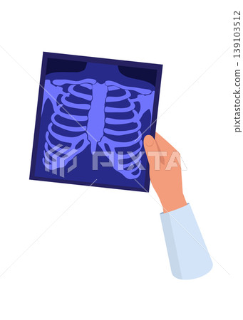 Hand Holding a Chest Xray Film Showing Rib Cage and Spine Hand Holding a Chest Xray Film Showing Rib Cage and Spine 139103512