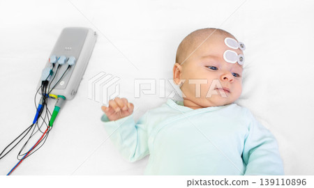 Newborn hearing screening and diagnosis at the hospital. Baby having hearing screening with special electrodes on his head and ear 139110896