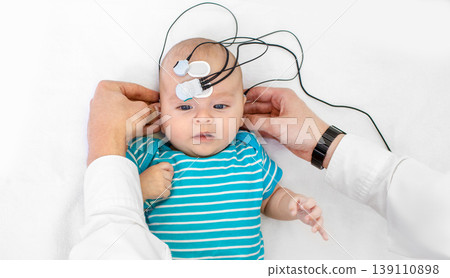 Newborn hearing screening and diagnosis at the hospital. Baby having hearing screening with special electrodes on his head and ear 139110898