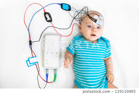 Newborn hearing screening and diagnosis at the hospital. Baby having hearing screening with special electrodes on his head and ear 139110905