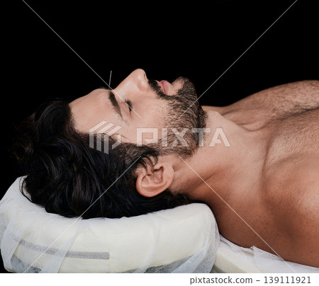 Male patient lies during acupuncture procedure in a wellness center with acupuncture needle in his forehead to relieve stress. Black background, side view Male patient lies during acupuncture procedure in a wellness center with acupuncture needle in his forehead to relieve stress. Black background, side view 139111921