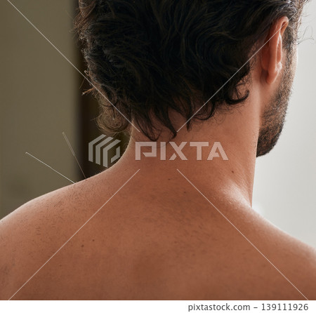 Treatment of back pain and shoulders tightness with acupuncture needles for a male patient. Alternative medicine, reflexology 139111926