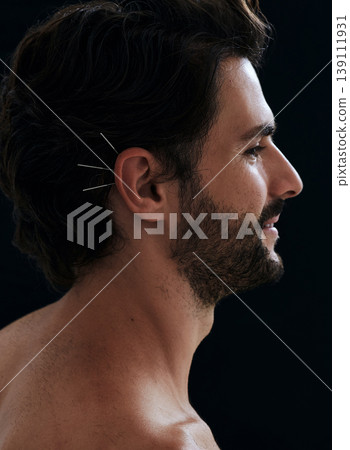 Handsome man having ear acupuncture for diseases treatment, over black background, side view. Acupuncture, reflexology, traditional Chinese medicine Handsome man having ear acupuncture for diseases treatment, over black background, side view. Acupuncture, reflexology, traditional Chinese medicine 139111931