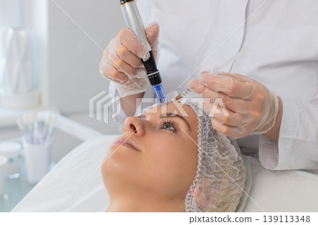 Microneedling dermapen mesotherapy for woman face regeneration by cosmetologist in beauty clinic spa Microneedling dermapen mesotherapy for woman face regeneration by cosmetologist in beauty clinic spa 139113348