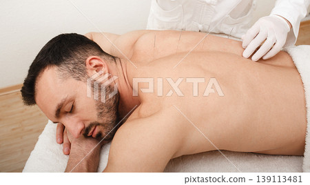 Man patient relaxes from acupuncture procedure. An acupuncturist doing acupuncture very accurately. Traditional chinese medicine Man patient relaxes from acupuncture procedure. An acupuncturist doing acupuncture very accurately. Traditional chinese medicine 139113481