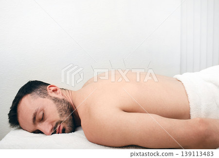 Man caucasian race getting acupuncture treatment. Acupuncture needles close up. Relax in the spa 139113483