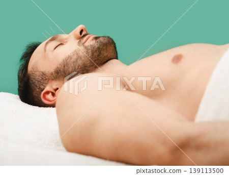Man caucasian race undergoing acupuncture treatment at the spa salon. acupuncture - an ancient treatment method in China 139113500