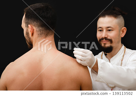 Reflexologist hand with acupuncture needle near the shoulder man. Treatment of a man body with Chinese medicine methods. Needles on a black background close-up Reflexologist hand with acupuncture needle near the shoulder man. Treatment of a man body with Chinese medicine methods. Needles on a black background close-up 139113502