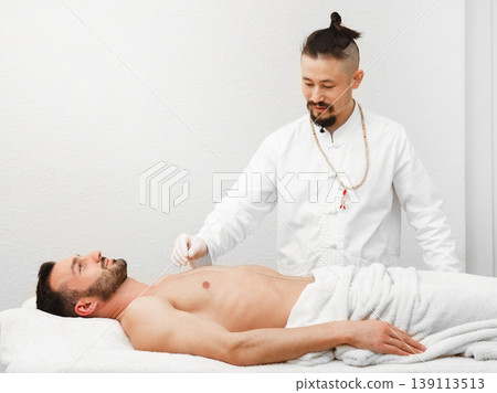 Acupuncturist inserts acupuncture needles at special points on the meridians of a man body. Alternative medicine, needle treatment 139113513