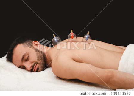 Health recovery man with vacuum cups. Closeup of vacuum cups on man's back on black background. Traditional oriental medicine. Health recovery man with vacuum cups. Closeup of vacuum cups on man's back on black background. Traditional oriental medicine. 139113532