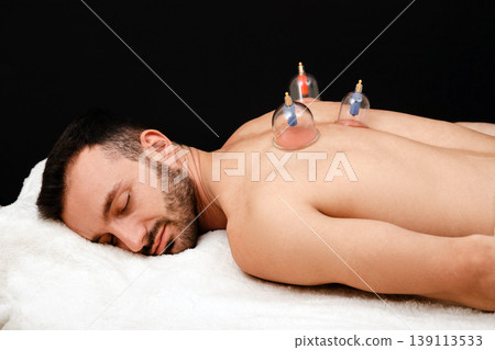 Man relaxes in spa with vacuum cups on his back. Vacuum cups for health treatment close-up on a black background Man relaxes in spa with vacuum cups on his back. Vacuum cups for health treatment close-up on a black background 139113533