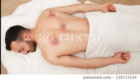 Caucasian man having traditional chinese treatment, acupuncture cups on male back, view from above 139113534