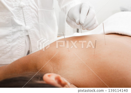 Osteochondrosis treatment with acupuncture. A woman in a spa salon treats her back with a certified reflexologist Osteochondrosis treatment with acupuncture. A woman in a spa salon treats her back with a certified reflexologist 139114140