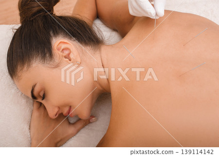 Woman enjoys the acupuncture procedure. acupuncturist doing acupuncture very accurately. Needle close up Woman enjoys the acupuncture procedure. acupuncturist doing acupuncture very accurately. Needle close up 139114142
