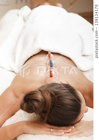Traditional chinese medicine. Woman recovery health with vacuum cups. Acupuncture cups on a woman's back 139114178