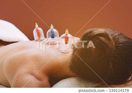 Treatment of pneumonia in a woman using vacuum cups. Vacuum cups enhance the patient's blood circulation. Say no pneumonia 139114179