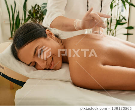 Alternative medicine, reflexology. Treatment of back pain with acupuncture needles for female patient. Traditional Chinese Medicine Alternative medicine, reflexology. Treatment of back pain with acupuncture needles for female patient. Traditional Chinese Medicine 139120865