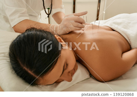 Adult woman relaxing and enjoying during acupuncture procedure. Spine acupressure, puncture of a meridian point on body patient Adult woman relaxing and enjoying during acupuncture procedure. Spine acupressure, puncture of a meridian point on body patient 139120868