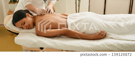 Acupuncture for a back of a asian woman in a Chinese traditional medical clinic Acupuncture for a back of a asian woman in a Chinese traditional medical clinic 139120872