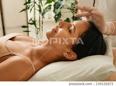 Reflexologist inserts acupuncture needles into acupuncture point on female head for headaches treatment. Traditional chinese medicine, reflexology Reflexologist inserts acupuncture needles into acupuncture point on female head for headaches treatment. Traditional chinese medicine, reflexology 139120873