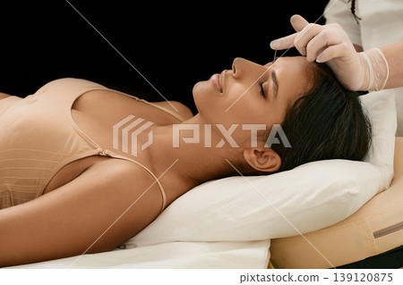 Needler inserts acupuncture needles into acupuncture point on female head for headaches treatment, isolated on black background 139120875