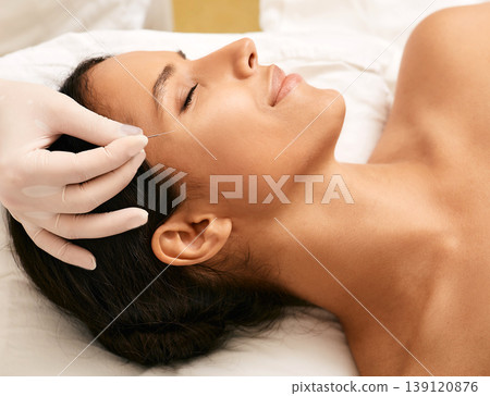 Acupuncture facelift. Facial acupuncture helps woman eliminate wrinkles, frown face lines Acupuncture facelift. Facial acupuncture helps woman eliminate wrinkles, frown face lines 139120876