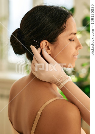 Acupuncture. Woman having ear acupressure or ear acupuncture , side view Acupuncture. Woman having ear acupressure or ear acupuncture , side view 139120889