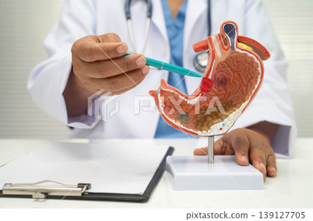 Stomach disease, doctor with anatomy model for study diagnosis and treatment in hospital. 139127705