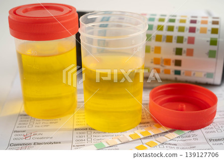 Urinalysis, urine cup with reagent strip pH paper test and comparison chart in laboratory. 139127706