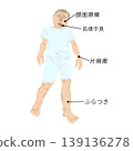 早期中風症狀圖示 | 顏面神經麻痺、言語不清、偏癱、眩暈 | 老年人異常體徵 139136278