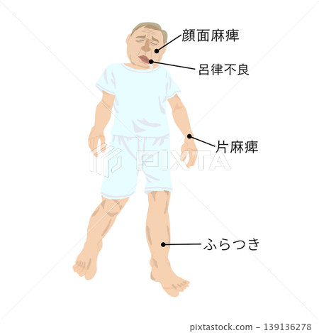 Illustrations of early stroke symptoms | Facial paralysis, slurred speech, hemiplegia, dizziness | Signs of abnormalities in the elderly 139136278