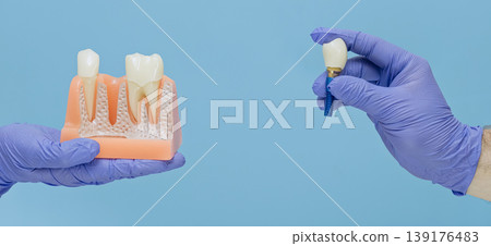 Dental implantation concept banner: Dentist holding an anatomical jaw model and a titanium tooth implant. Dental implantation concept banner: Dentist holding an anatomical jaw model and a titanium tooth implant. 139176483