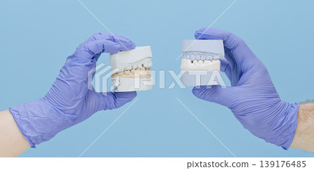 Orthodontics concept banner: Dentist hands holding two plaster dental jaw models for bite comparison. 139176485