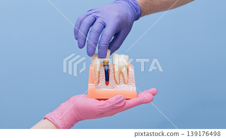 Dentist hand in blue glove installing ceramic crown onto titanium implant in anatomical jaw model held by assistant. Dentistry banner concept. Dentist hand in blue glove installing ceramic crown onto titanium implant in anatomical jaw model held by assistant. Dentistry banner concept. 139176498