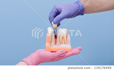 Dentist hand inserting a complete titanium dental implant into an empty bone socket of a jaw model. Implantology surgery concept. Dentist hand inserting a complete titanium dental implant into an empty bone socket of a jaw model. Implantology surgery concept. 139176499