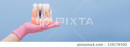Dentist hand in pink glove holding jaw model with titanium dental implant. Wide dentistry banner with copy space. Dentist hand in pink glove holding jaw model with titanium dental implant. Wide dentistry banner with copy space. 139176500