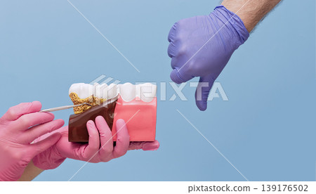Bad oral hygiene concept. Dentist hands holding tooth model with periodontitis and showing thumbs down dislike gesture. Bad oral hygiene concept. Dentist hands holding tooth model with periodontitis and showing thumbs down dislike gesture. 139176502