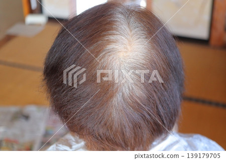 Women who are troubled by a decrease in hair elasticity and body 139179705