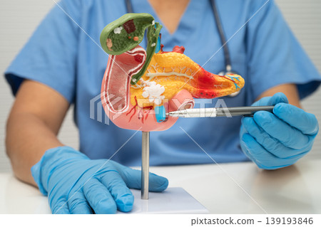 Pancreatitis, pancreatic cancer, Asian doctor with pancreas, gallbladder and bile duct human anatomy model at hospital. Pancreatitis, pancreatic cancer, Asian doctor with pancreas, gallbladder and bile duct human anatomy model at hospital. 139193846